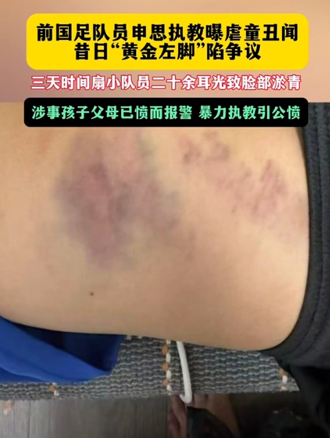 前国脚申思训练中掌掴小球员 家长已报警 前国脚申思训练中掌掴小球员 家长已报警